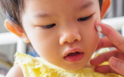 Comment soigner une peau à tendance atopique?